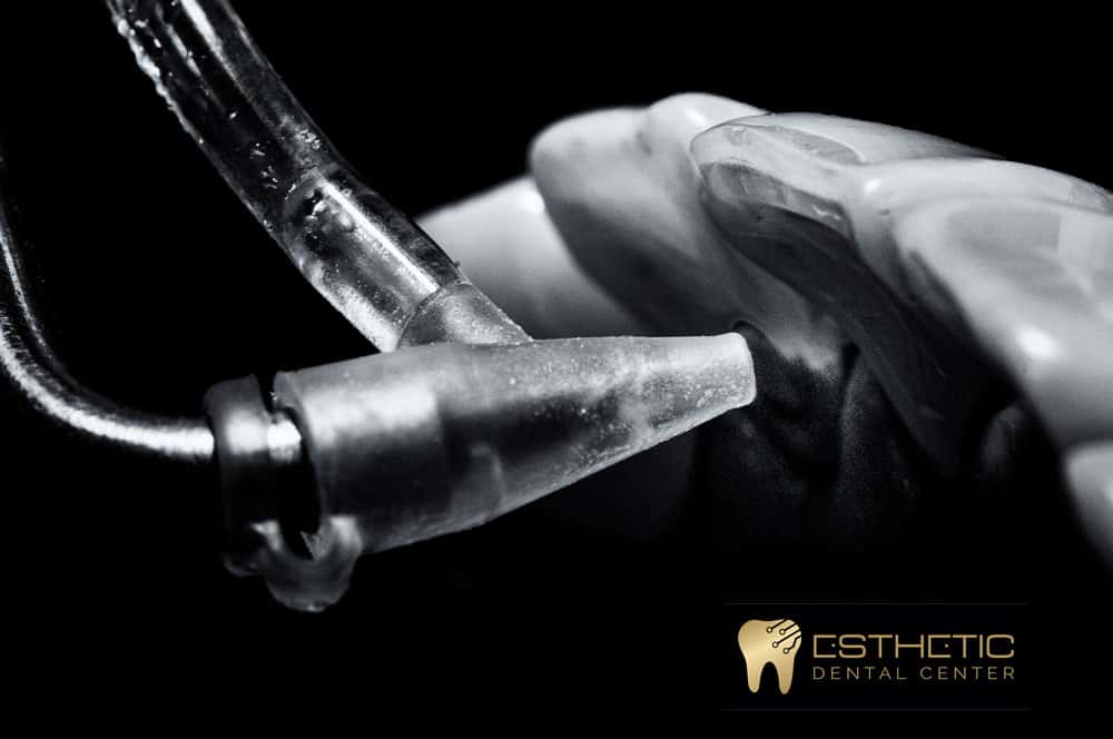 Manchas-en-los-dientes