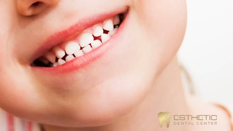 infeccion-de-caries-en-dientes-de-leche
