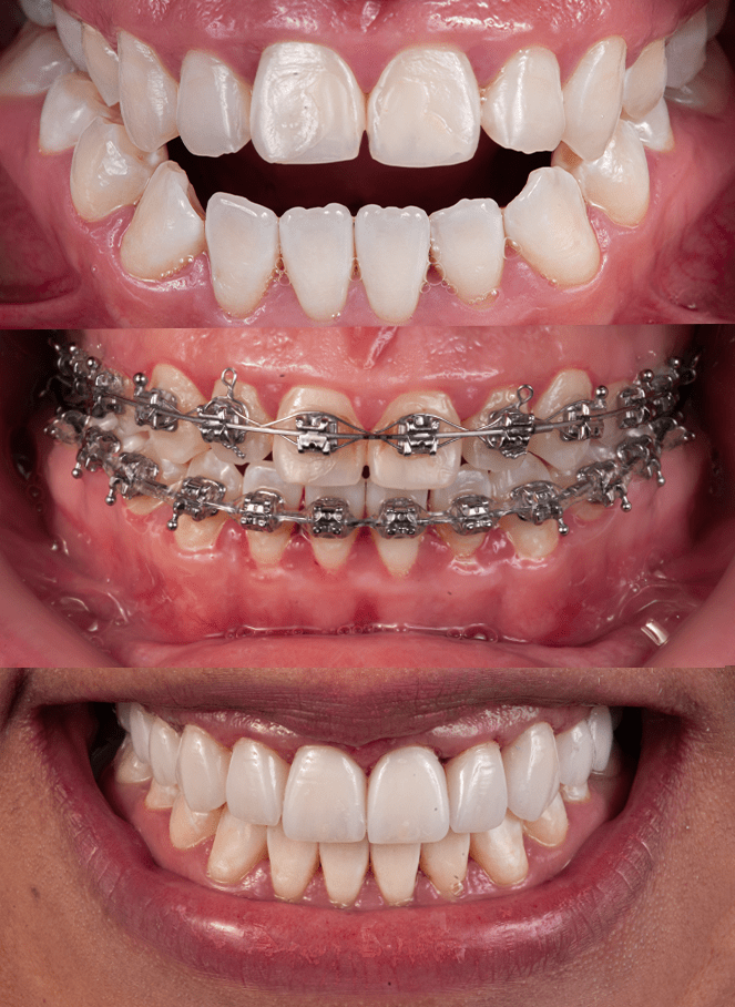 ortodoncista en queretaro