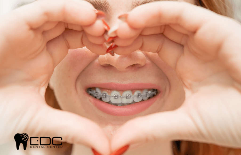 La Conexión Entre Tu Salud Bucal y Tu Corazón: Lo Que Necesitas Saber