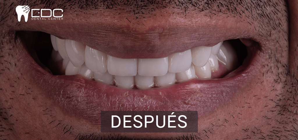 dentistas en queretaro despues