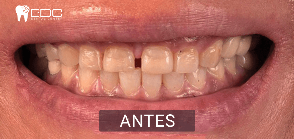 los mejores dentistas en queretaro antes