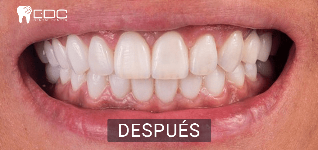 los mejores dentistas en queretaro despues