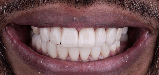 dentistas en queretaro despues 1