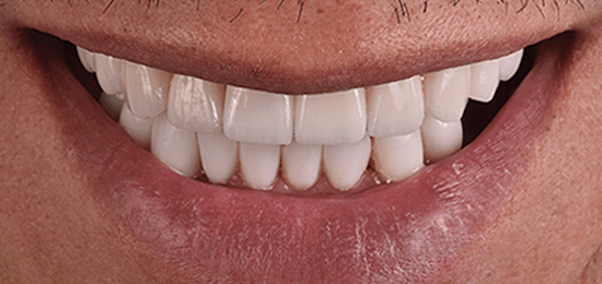 los mejores dentistas en queretaro antes 2