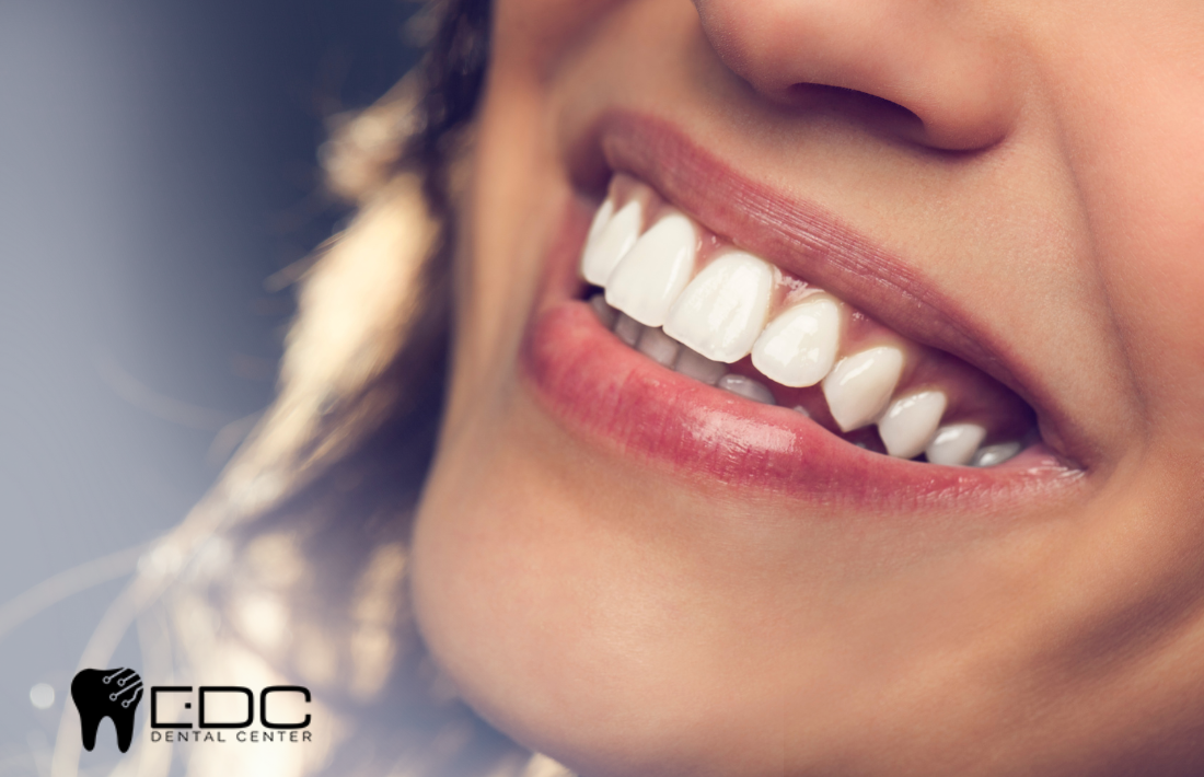 you have stains on your tooth